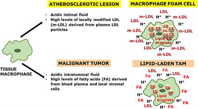Lipid-Laden Macrophages and Inflammation in Atherosclerosis and Cancer: An Integrative View